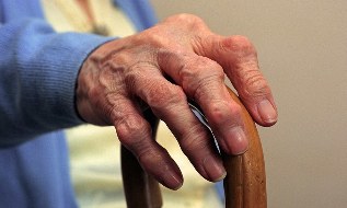 Artritis eta behatzen artrosia adineko pertsona batean