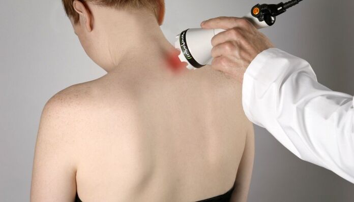 Osteokondrosi zerbikalerako laser terapia